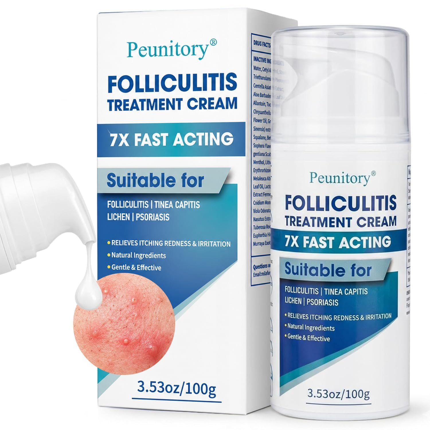 Folliculitis Treatment Cream – 5% Benzoyl Peroxide Treatment for Scalp, Body & Back Bumps, Fast-Acting Relief Ointment for Itching, Redness & Acne, with Centella & Ceramides, Sensitive Skin, 3.53 oz